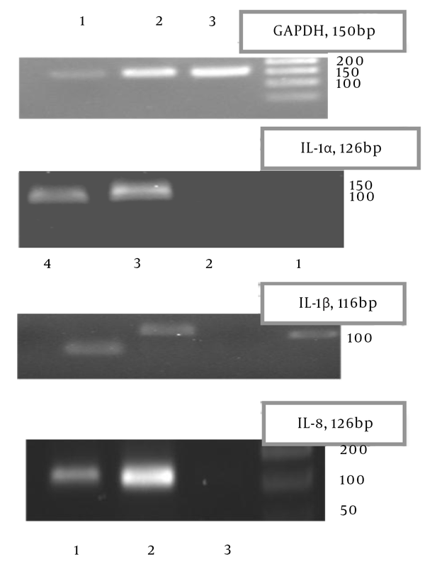RNA quality was assessed by PCR using primers for GAPDH. The induction of IL-1α, IL-1β and IL-8 was examined. 1; THP-1 cell treatment with native shiga toxin; 2, THP-1 cell treatmment with recombinant toxin; 3, control THP-1 cell.