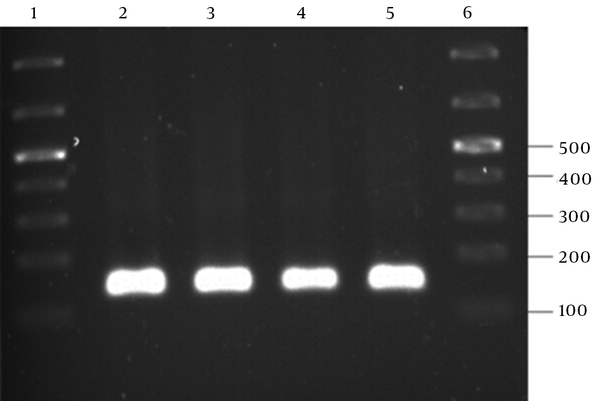 Lanes 2–5, reveal amplification of a 130-bp PCR product; Lanes 1 and 6, GeneRuler 100-bp DNA ladder (Thermo Scientific, Waltham, MA, USA)