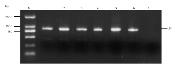 M, DL2000 DNA marker; 1 - 6, randomly selected colony; 7, negative control.