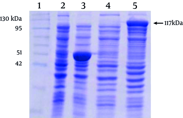 Lane 1 indicates a pre stained protein molecular weight marker (Vivantis, Malaysia). Lanes 2 and 3 and lanes 4 and 5 represent the protein profiles of non-recombinant and recombinant bacteria before and after induction by IPTG, respectively. The expression of a protein of about 117 kDa, corresponding to the predicted molecular weight of MBP-NS3 is shown in the lane 5. The major protein of about 50 kDa, in the lane 3, corresponds to MBP plus α fragment of beta-galactosidase, expressed in non-recombinant bacteria after adding IPTG.