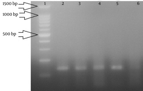 Gel Electrophoresis of the Polymerase Chain Reaction Products From OmpW Gene