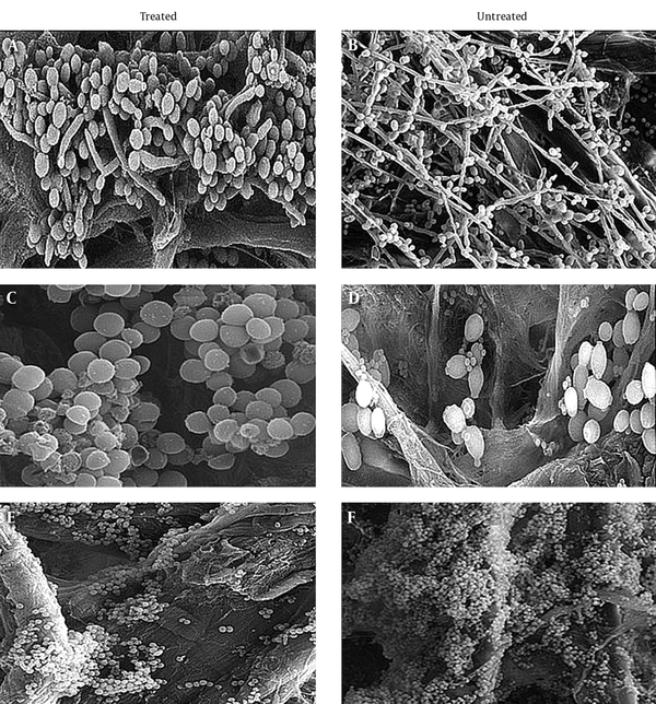SEM images of reference and knockout strain biofilms at maturity, before and after treatment. Biofilms were cultured for 48 hours at 37°C under static conditions in YPL medium and visualized at 500× magnification. A, Treated wildtype ICL1/ICL1; B, untreated wildtype ICL1/ICL1; C, treated ICL1/icl1; D, untreated ICL1/icl1; E, treated icl1/icl1, and F, untreated icl1/icl1. Images have been reconstructed to permit clear viewing.