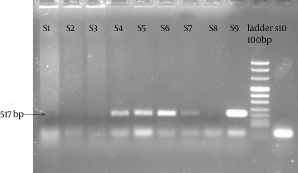 The figure presents PCR amplification of C. trachomatis K/SotonK1 plasmid pSotonK1 (517 bp). Sample 1 (S1), S2 and S3 as well as S8 presents the negative samples and negative control, respectively. S4, S5 and S6 are positive samples and S9 is positive control.