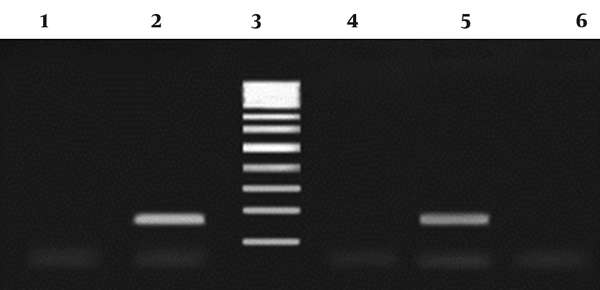 Lane 1: Negative control; lanes 2 and 5: positive samples (171 bp); lane 3: 100 bp DNA ladder; and lanes 4 and 6: negative samples.