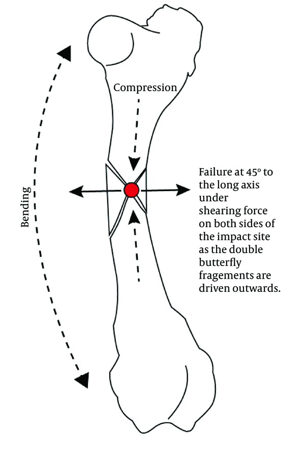 The Previously Proposed Double Butterfly Fracture Mechanism