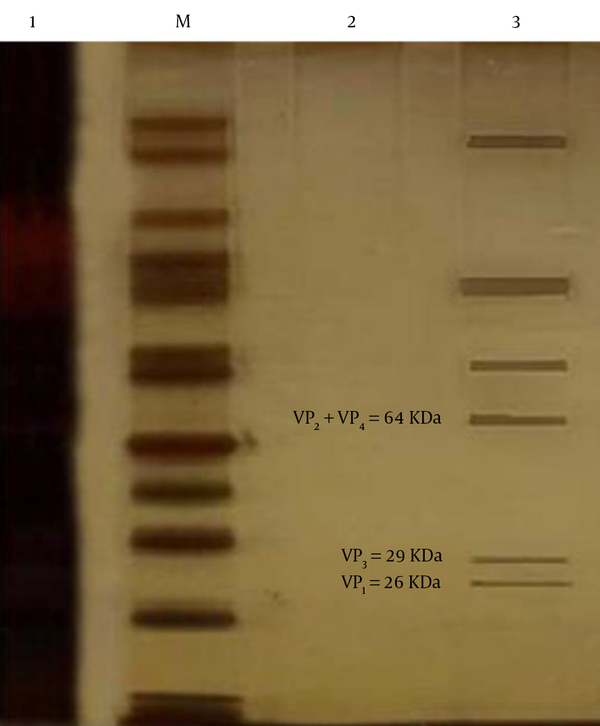 M: Marker, 1: Primary sample, 2: Negative control, 3: Purified sample.