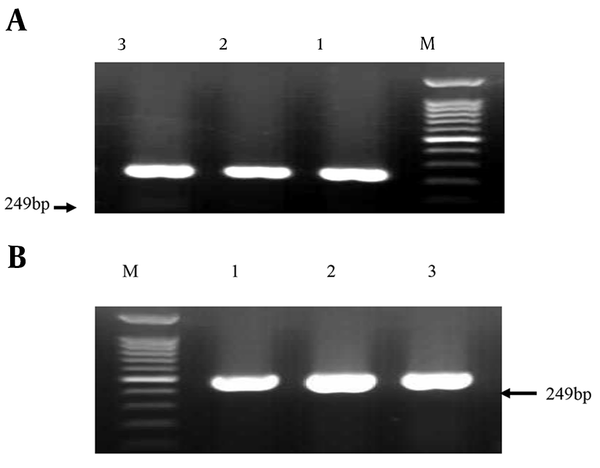 A) PCR amplification of oprI gene among suspected isolates for detection of Pseudomonas spp. M, 1 kb DNA size marker; lane 1, positive control P. aeruginosa ATCC 27853; lanes 2 and 3, positive isolates. B) PCR amplification of oprL gene among suspected isolates for detection of P. aeruginosa. M, 1 kb DNA size marker; lane 1, positive control P. aeruginosa ATCC 27853; lanes 2 and 3, positive isolates.