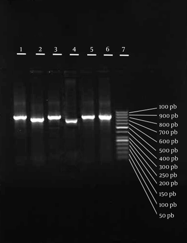 Lane 7, 50 bp molecular marker; lanes 1 to 6, coa gene PCR products of various isolates.