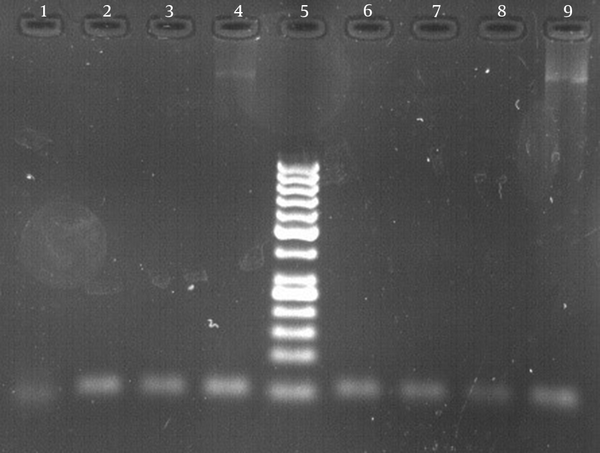 Lane 1, negative control; Lane 4, positive control of standard M. tuberculosis strain (H37Rv ATCC 27294); Lane 5, DNA size marker with bands at 50-bp intervals starting at 50 bp; and other lanes show the PCR products of the M. tuberculosis isolate.
