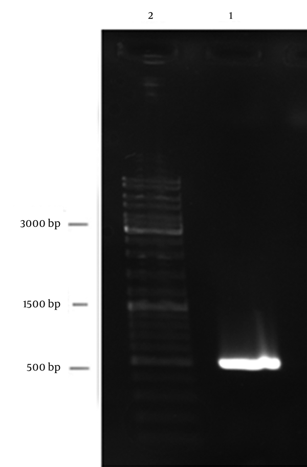 Lane 1: single expected band of pe gene (483bp), lane 2: DNA lader mix.