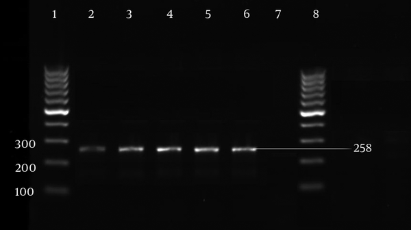 Lanes 1 and 8: 100 bp DNA ladder. Lanes 2-5: isolates with blaIMP gene in 258 bp. Lane 6: positive control (Clinical P. aeruginosa with sequenced blaIMP gene). Lane 7: negative control (distilled water).