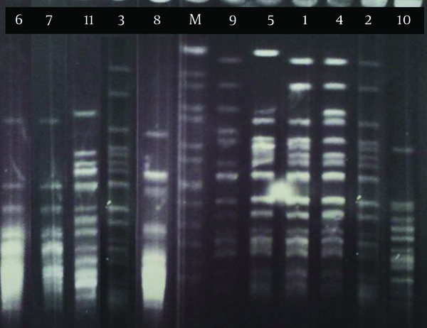 Lane M, genomic pattern of S. braenderup H9812 as a marker.
