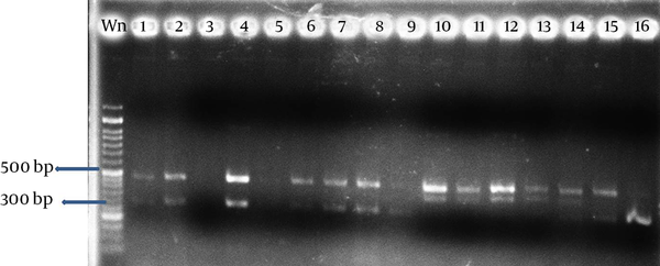Results of the 16 Isolates Were Used for Amplified With PfrBtD11b Primer 2% Agarose Gel Electrophoresis, Wm Represents the Molecular Weight Marker of 50 bp is Indicative
