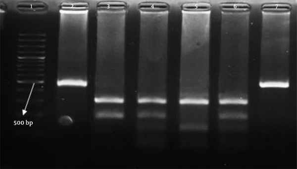 Lane 1, DNA marker (100 bp); lanes 2 and 7, PCR products (484 bp); lane 3, CC genotype; lanes 4 and 6, CT genotype; lane 5, TT genotype.