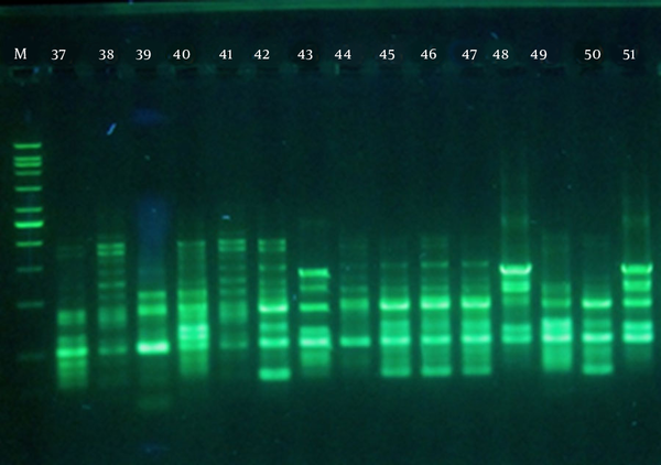 M, 100-bp DNA molecular weight marker, profiles 37 - 42 show the DNA fingerprints of non-burn isolates; 43 - 51 represent the DNA profiles of burn isolates.