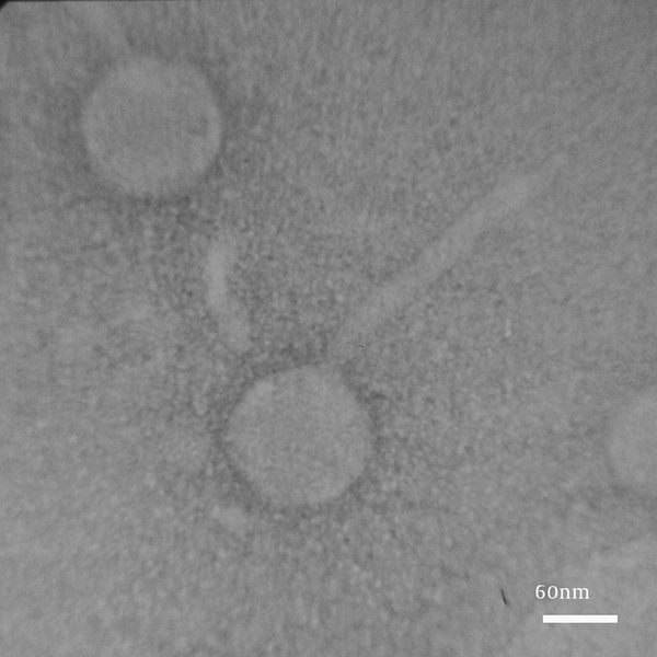 Electron Micrographs of the Family Siphoviridae Phage Serogroup F Negatively Stained With 2% Uranyl Acetate (pH = 4 - 4.5). Voltage 150 kV, Scale Bar = 60 nm