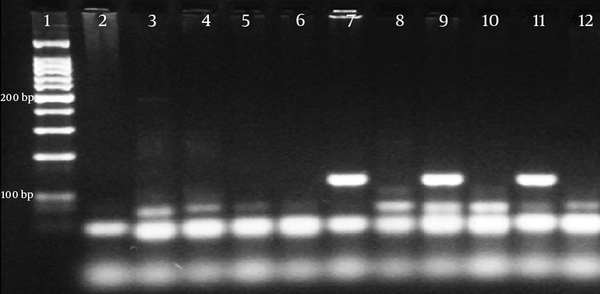 Lane 1, 100 bp DNA ladder; lane 2, negative control, lane 7, sample 1; lane 9, sample 2; lane 11, sample 4 (129 bp); lane 9, negative control.