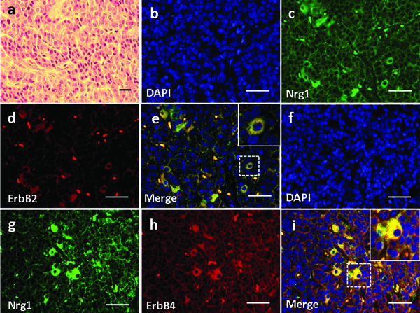 (a) H &amp; E staining. (b-i) Double Immunofluorescence Staining for Nrg1 with either ErbB2 (b-e) or ErbB4 (f-i) was shown. Scale bars = 50μm.