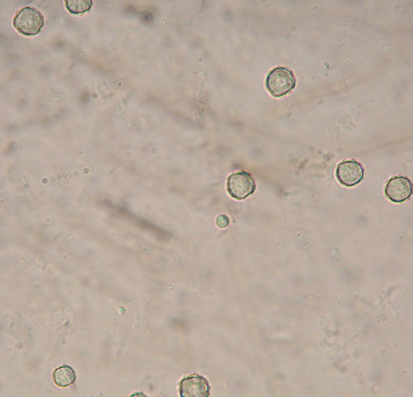 Cyst of  Acanthamoeba  Species After Isolation From Water Samples and Cultivation; × 400, (Authors Source)