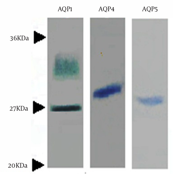 The cells were separately immune labeled with primary antibodies followed by fluorescein isothiocyanate (FITC) conjugated secondary antibody and visualized by ﬂuorescence microscopy at 400x magniﬁcation. Arrows indicate the cell membrane. A: the immunoreactivity of APQ1 with the arrow showing that AQP1 is selectively localized in the membrane of choroid plexus cells. B: immunoreactivity of CP cells with an antibody against AQP4, with the arrow showing the unstained cell membrane; an indication that AQP4 expression only occurs in the cytoplasm of the cells. C: expression of AQP5 in CP cells; this protein is weakly expressed in the cytoplasm of CP cells. Arrow points to the lack of expression of AQP5 in the cell membrane.
