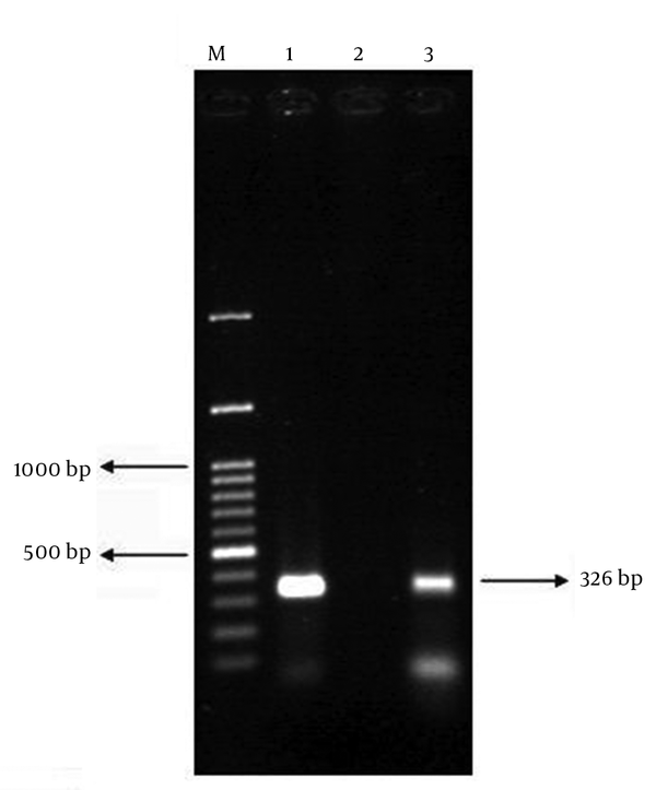 PCR Results of bfp Gene on Agarose Gel; Positive Control (Lane 1), Negative Control (Lane 2), and a Positive Clinical Isolate (Lane 3)