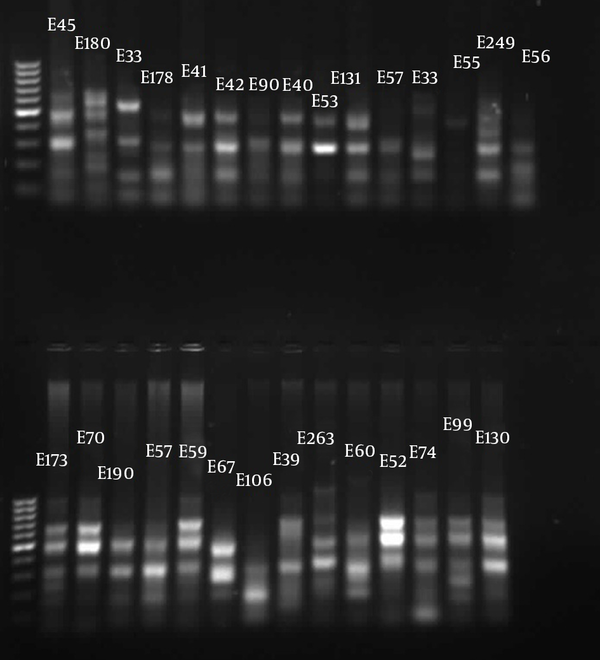 1, 100 bp DNA ladder (Fermentas, Latvia); E lines, Pseudomonas aeruginosa isolates from Emam Khomeini Hospital.