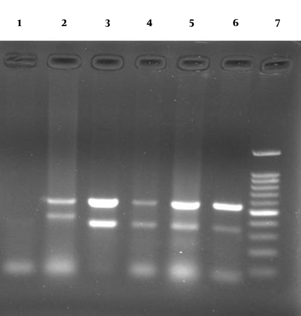 Agarose gel (1.2%) containing PCR products from allele d1 (367-379 pb) and allele d2 (298 pb) of vacA gene and 16S rDNA gene (519 bp): lane 2: positive control (Strains J99 and Tx30a) representing the allele d1, lanes 3-6: clinical positive strains representing the allele d2, lane 1: negative control and lane 7: 100-bp DNA ladder