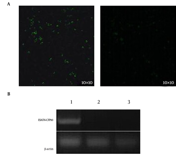 The ESAT6-CFP10 was fused to the N terminal of GFP of the pEGFP-N1 expression vector. A, the expression of the fusion protein was detected with fluorescence signals, using a fluorescence microscope; 1, NR8383 transfected with the recombinant eukaryotic plasmid pEGFP-N1-ESAT6-CFP10; 2, NR8383 non-transfected with the recombinant eukaryotic plasmid pEGFP-N1-ESAT6-CFP10; B, the mRNA level of ESAT6-CFP10 was analyzed with RT-PCR using total RNA extracted from cells; lane 1, the gene amplified from the NR8383-EC cells; lane 2, the gene amplified from NR8383 cells transfected with pEGFP-N1 plasmid; Lane 3, the gene amplified from non-transfected NR8383 rat alveolar macrophages.