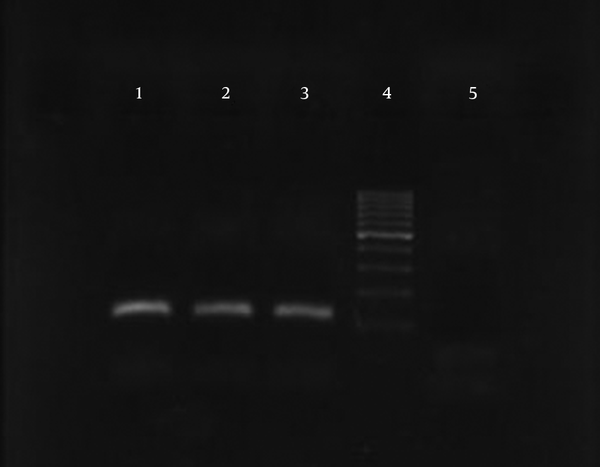 Lane 1, negative control; Lane 2, positive control of M. tuberculosis strain (H37Rv ATCC 27294); Lanes 3, 5, and 6, M. tuberculosis isolates; and Lane 4, DNA size marker with bands at 100 bp.