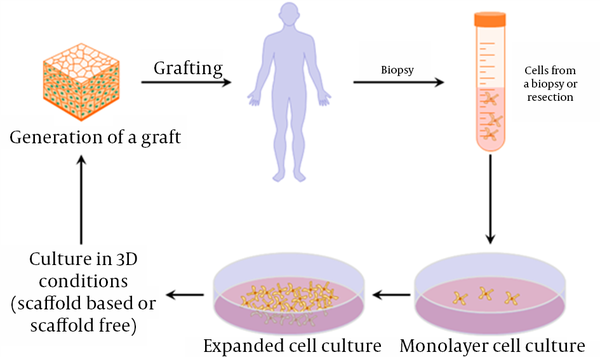 Combination of Tissue Engineering and Cell Therapy