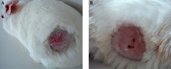 (A) and 9 days after T-2 toxin administration and treatment with eucerin (B). Erythema, inﬂammation, and tissue necrosis are the characteristic features of the effect of T-2 toxin (A). A central necrosis surrounded by an erythematic reaction is observed (B).