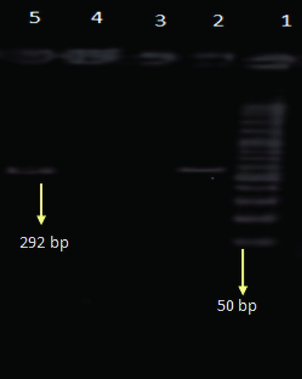 Lane 1: 50-bp DNA size marker, Lane 1: positive control, Lane 3: negative control, Lane 4: negative sample, Lane 5 positive sample