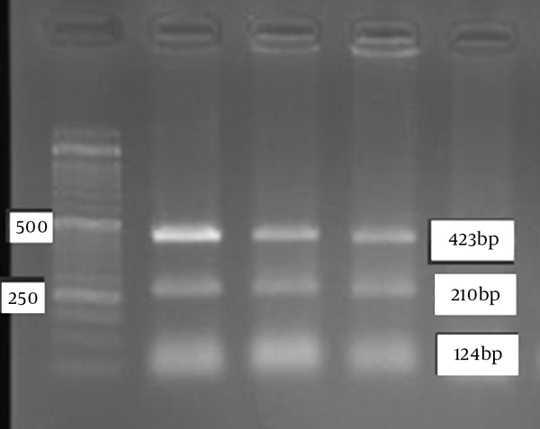The Results of TaqI Digestion for the Detection of p.G61E