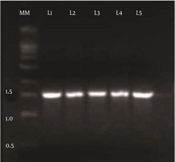 MM, Molecular Marker (1 kb DNA ladder); L1, DSVP13; L2, DSVP14; L3, DSVP18; L4, DSVP25; L5, DSVP26.