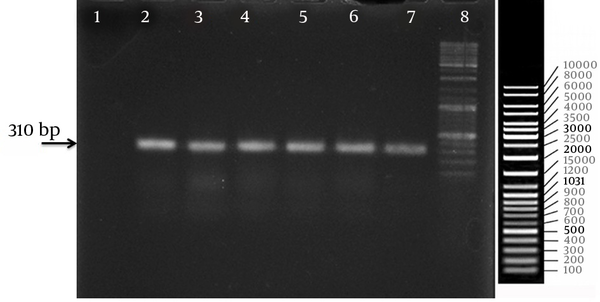 Lane 1: negative control (without template); Lanes 2, 3, 4, 5, 6: amplicon bands from clinical isolates; Lane 7: amplicon band from standard isolate; Lane 8: DNA size marker (100-bp DNA ladder).