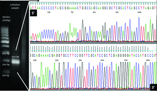 Gel Electrophoresis Result of an Amplified Partial NS3 Fragment and Its Sequence Obtained by Direct Sequencing Method for Iranian GB virus C