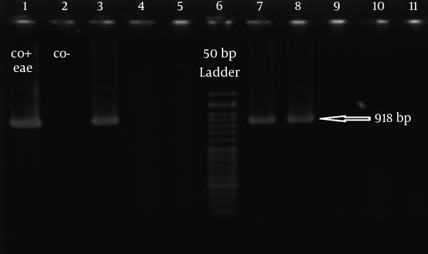 Lane 1, eae positive control E. coli E2348.69; lane 2, negative control; lanes 3, 7, 8, eae positive E. coli isolates; lane 6, 50 bp DNA ladder (Fermentase, Germany).