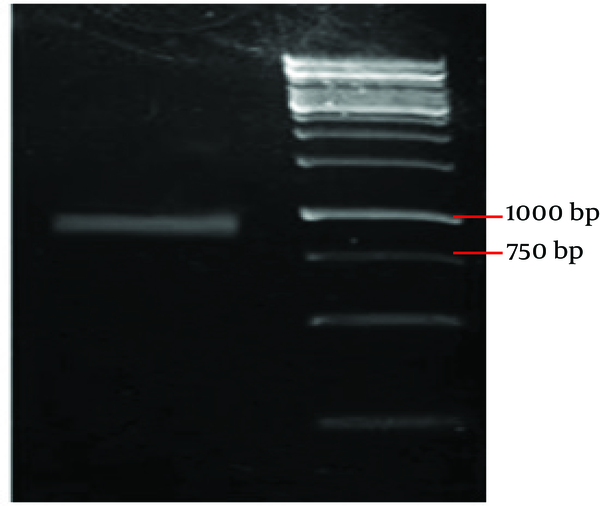 Lane1: band of 978 bp. Lane2:1kbp DNA marker (Fermentas)
