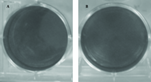 A: Tenfold dilution (10-4) of DLP without transfectant; B: 10-3 DLP without transfectant.