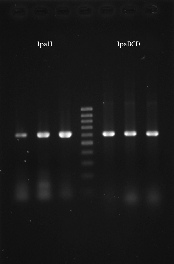 Lane 1 and 2, IpaH gene product (619-bp) from representative strains; lane 3, IpaH gene product from S.flexneri ATCC 12022 as a positive control; lane 4, DNA molecular size marker (100-bp Ladder); lane 5, IpaBCD gene product (612) from S. flexneri ATCC 12022 as a positive control; lane 6 and 7, IpaBCD gene product form representative strains.