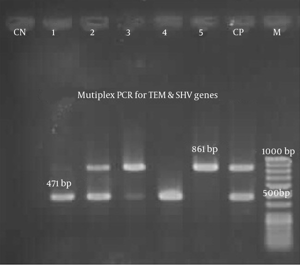 Lane 1 displays a 471 bp fragment of the SHV gene. Lane 5 displays an 861 bp fragment of the TEM gene. Lanes 2 and 3 are positive for SHV and TEM. Lane M represents the 100 bp DNA ladder. Lane NC: negative control. Lane PC: positive control.