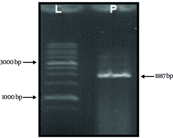 L: 1 kb ladder. P: PCR product