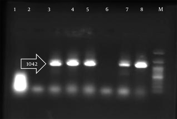 Lane 1, negative control; Lane 8, positive control; Lane M, the ladder; Lanes 2 - 7 are samples. Pir1 gene with 1041 bp length was found in positive samples as 3, 4, 5 and 7.