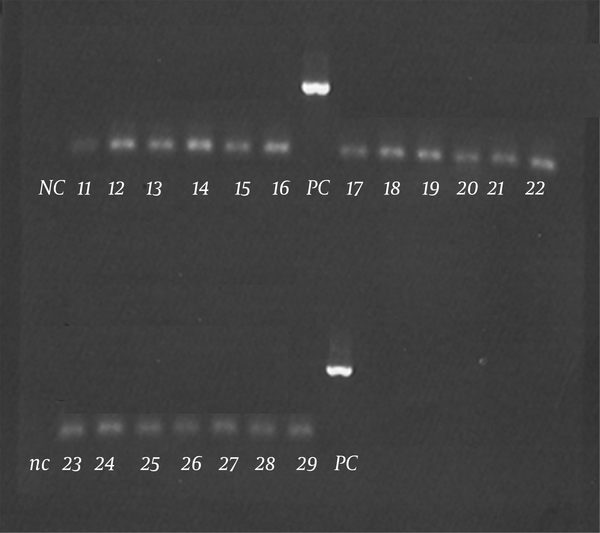 The lanes show the PCR products. NC, negative control; PC, positive control; Samples 11 To 29 are negative.
