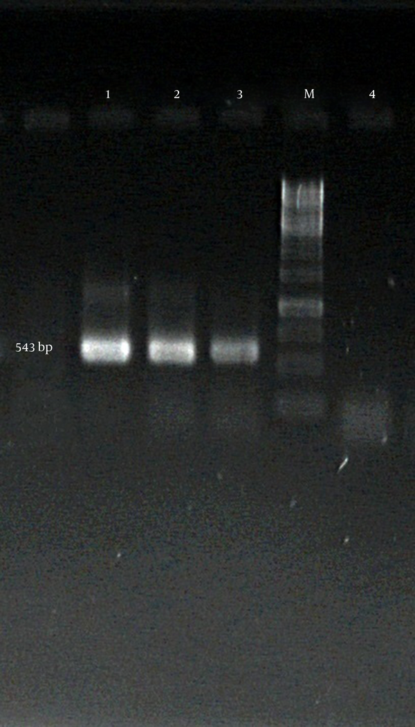 M: GeneRuler™ 1 kb DNA ladder (fermentas); lanes 1 - 3: randomly selected colonies; lane 4: negative control (colony containing pET43.1a+ without cpcB gene)