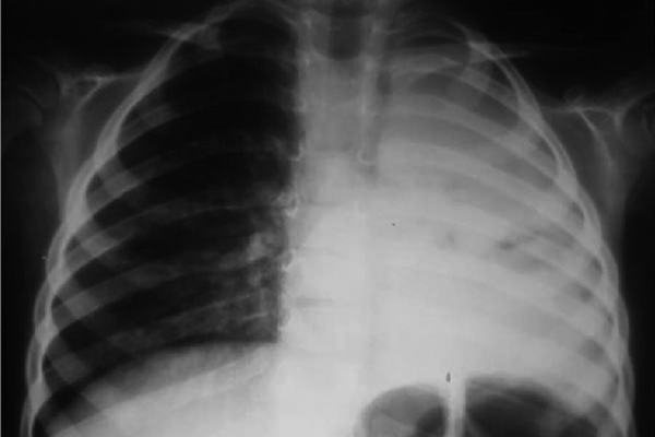 Chest Radiography of the Patient