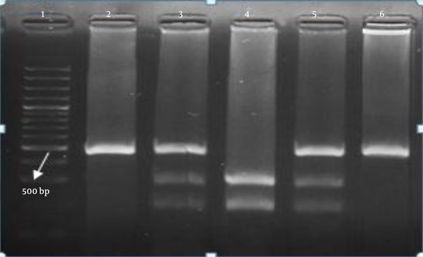 Lane 1, DNA marker (100 bp); lane 2, PCR product; lanes 3 and 5, AG genotype; lane 4, AA genotype; lane 6, GG genotype.