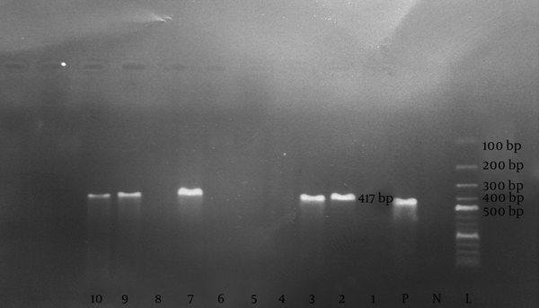 PCR products were detected by the 2% agarose gel supplemented with safe stain; L, 100 bp DNA ladder; N, negative control; P, positive control; 1 to 10, Patients’ samples.