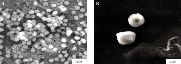 Scanning Electron Micrographs of A. niger cells when (A) untreated and (B) treated with 0.1 mL of MEb after incubation for 48 hours at 28°C in 10 mL of PDB