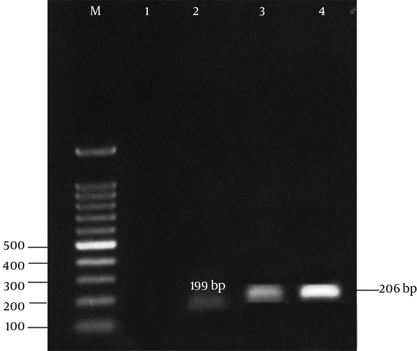 Lane M, 50 bp ladder marker; lane 2, tetE gene found at 199 bp; lane 3, 4, tetB gene found at 206 bp.